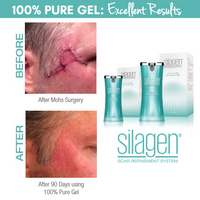 Silagen Scar Refinement System - 100% Pure Silicone Gel for Scars